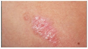 5 warning signs your skin is giving you
