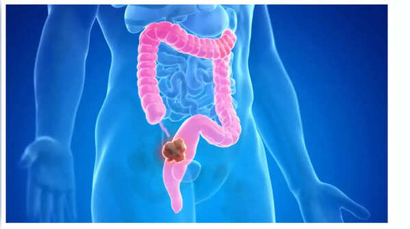 Noticeable rapid weight loss