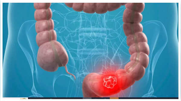 Experiencing abdominal pain