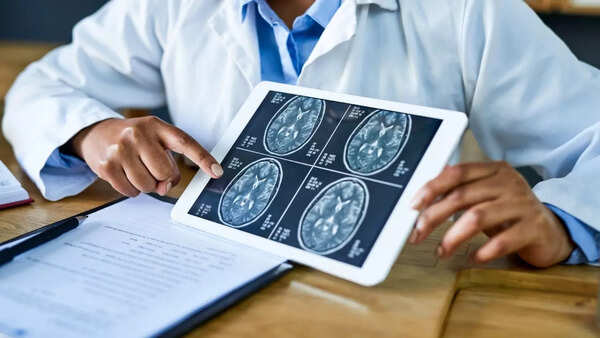 Illustration of the human brain with glowing connections
